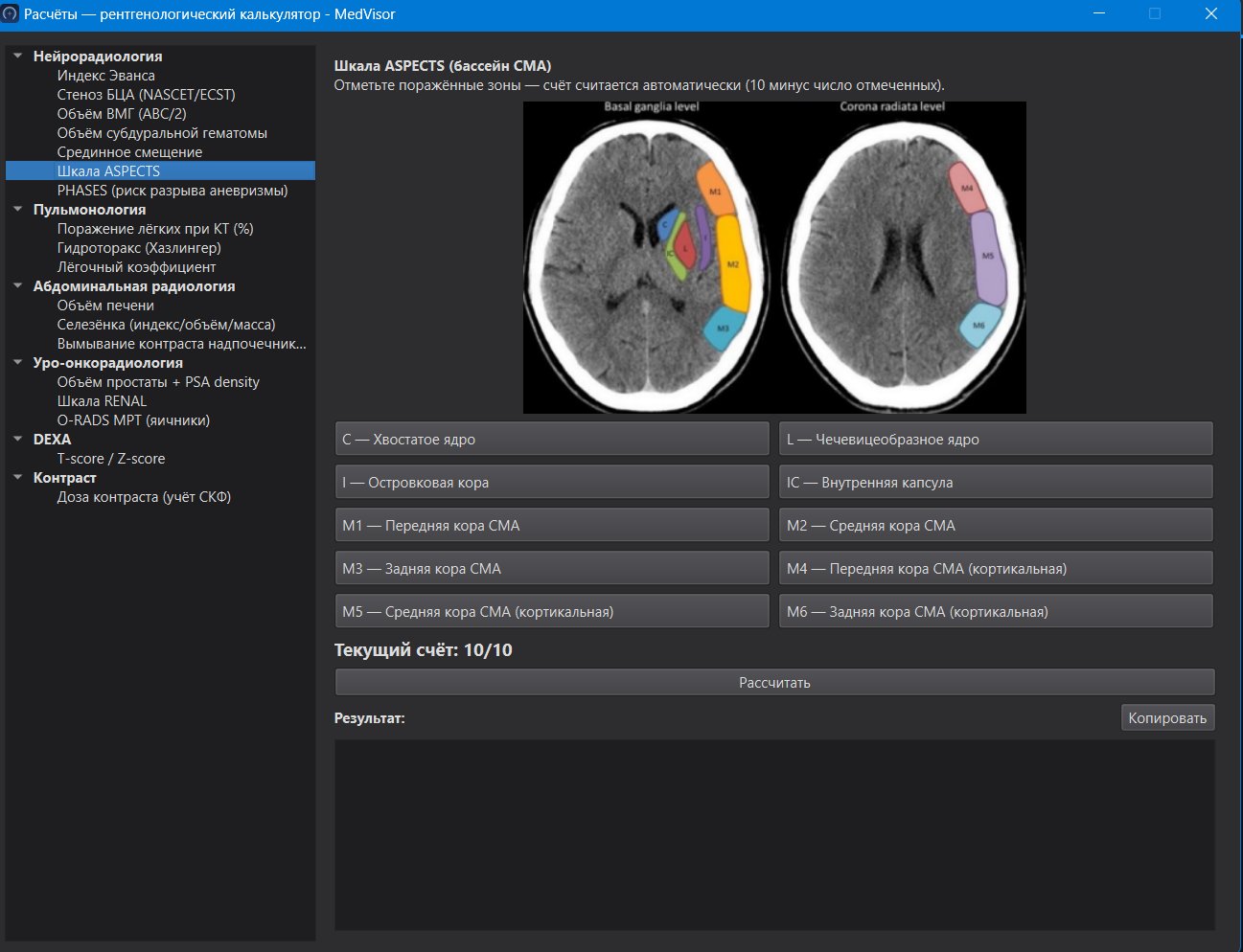 Рентгенологические расчёты в MedVisor